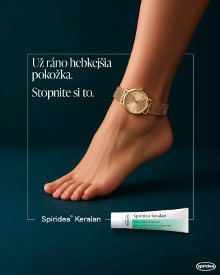 So Spiridea Keralan 🧴 pocítite zmeny už nasledujúce ráno, a do siedmich 7️⃣ dní sa popraskanej koži zbavíte. ⏱️Stopnite si...